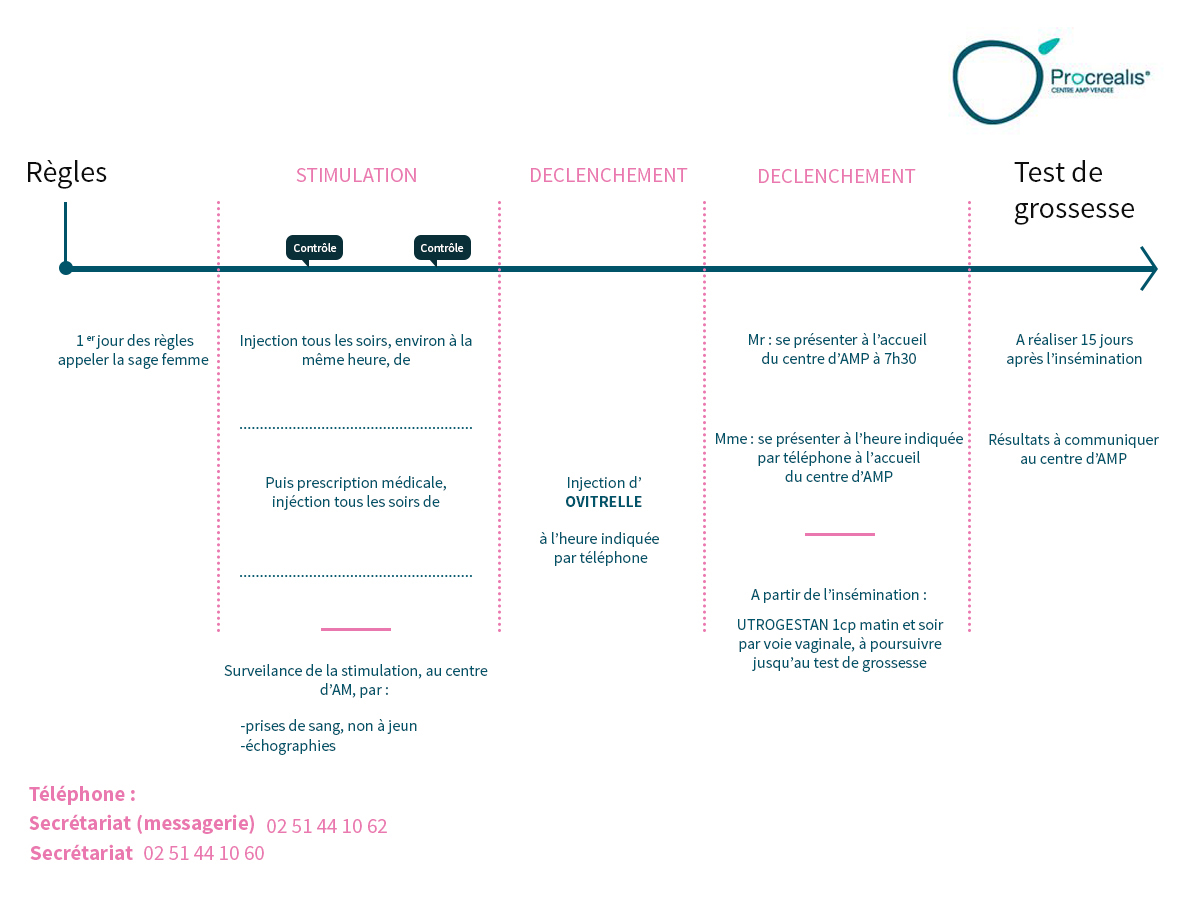 insemination-intreauterine - Procréalis